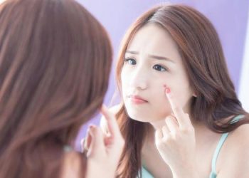 mengatasi jerawat pada wanita