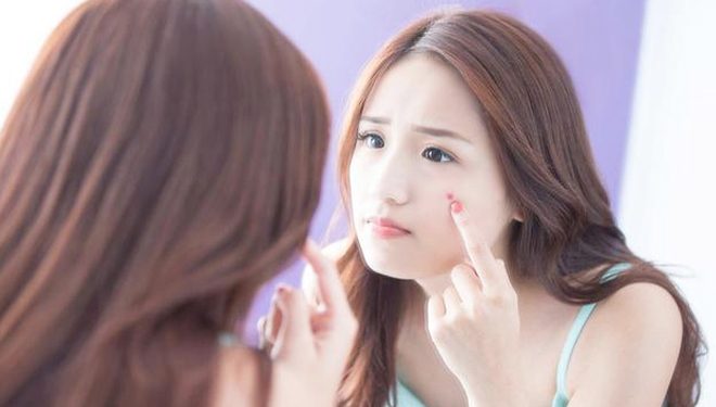 mengatasi jerawat pada wanita