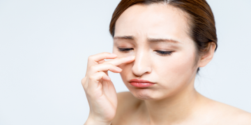 cara menghilangkan komedo