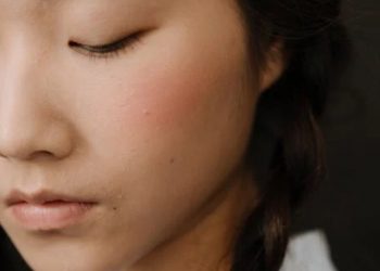 Mitos dan fakta seputar jerawat di wajah yang harus Anda tahu - Jerawat hanya terjadi saat remaja