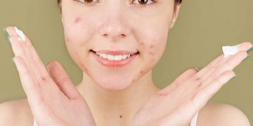 Erha21 Acne Care Lab Gentle Acne Moisturizer