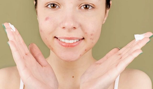 Erha21 Acne Care Lab Gentle Acne Moisturizer